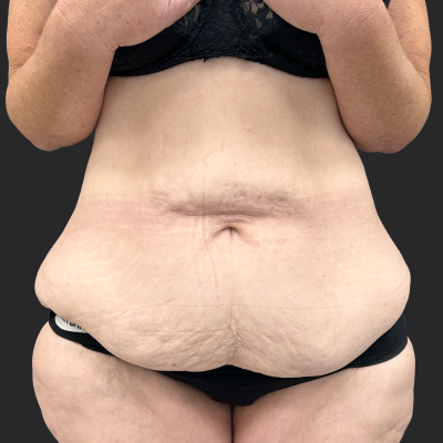 Before — result 3, Dr. Guy Rasner