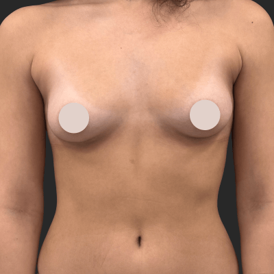 Before — result 4, Dr. Guy Rasner
