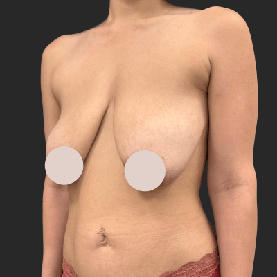 Before — result 5, Dr. Guy Rasner