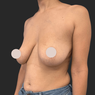 Before — result 6, Dr. Guy Rasner