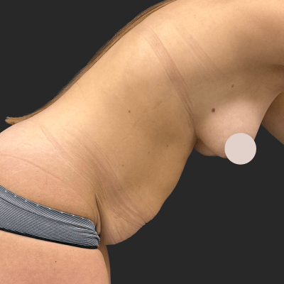 Before — result 8, Dr. Guy Rasner