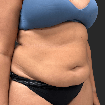 Before — result 9, Dr. Guy Rasner